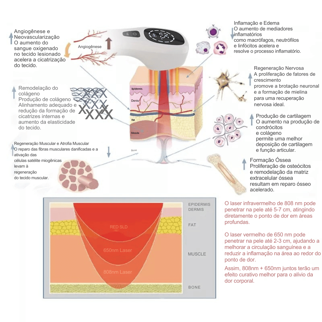 Dispositivo de Terapia a Laser Frio para Alívio da Dor